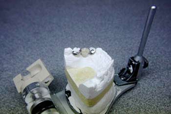 Proserve Dental Ceramics Chelmsford image 2