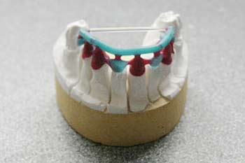 Proserve Dental Ceramics Chelmsford image 3