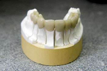 Proserve Dental Ceramics Chelmsford image 4
